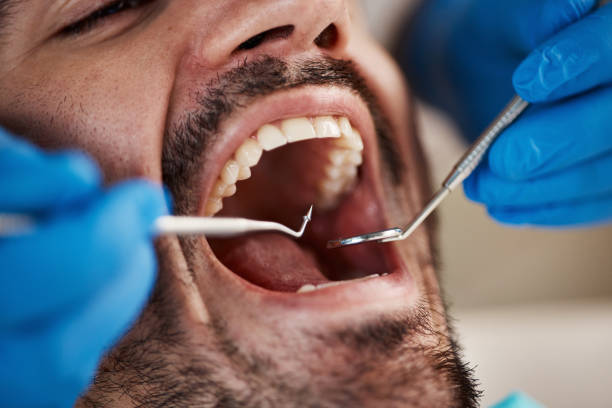 Best Emergency Denture Repair in Dover, NH